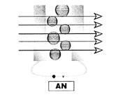 Gallery image of the project Dreierwette