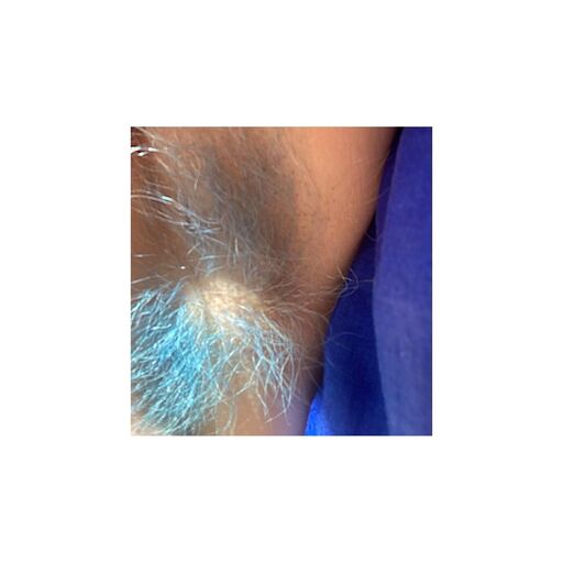 Cover image of the project W-haarnsinnig haarig