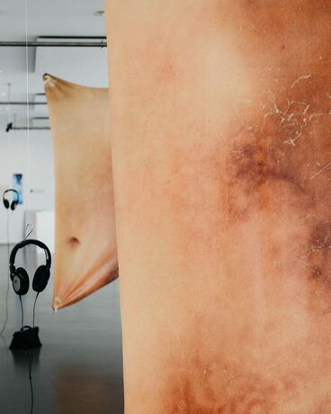Do you wanna hear about the tear in my body? Gallery image of the project Do you wanna hear about the tear in my body?