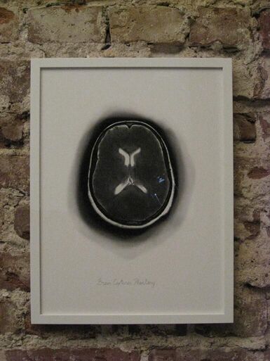 Cover image of the project Brain Captures Phantasy
