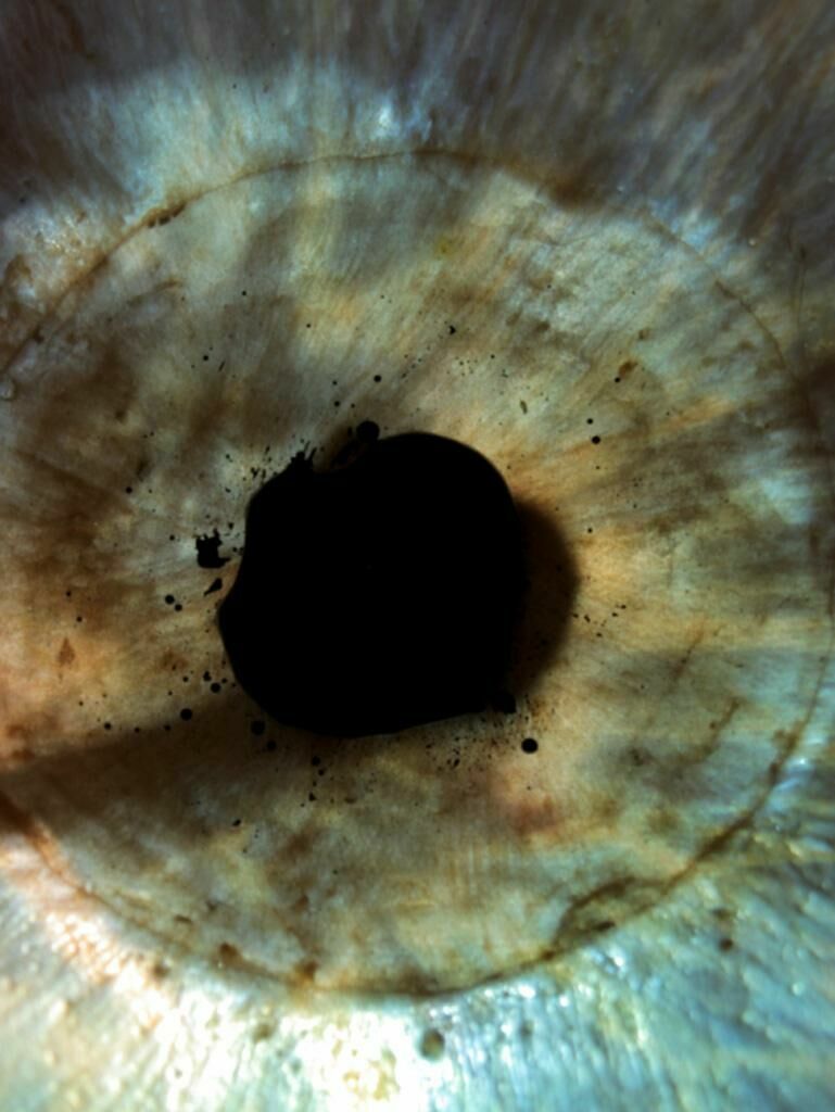 Cover image of the project Augentinte