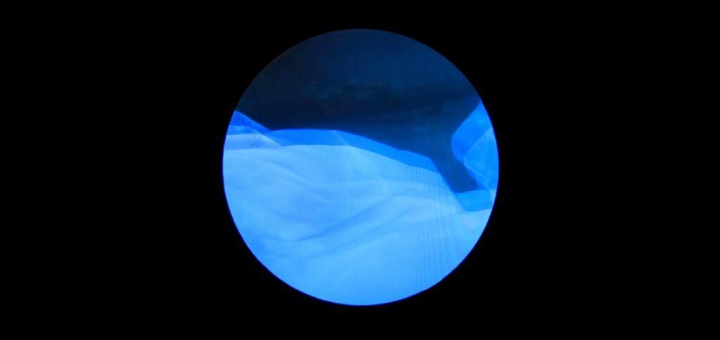 Gallery image of the project 70.7 BLUE