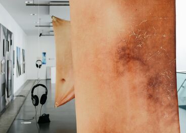 Do you wanna hear about the tear in my body? Gallery image of the project Do you wanna hear about the tear in my body?