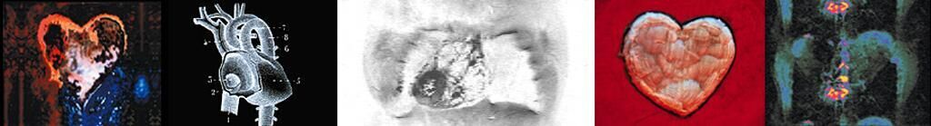 Cover image of the project Nothing Broke but the Heart 